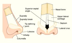 Rinoplastia tenerife